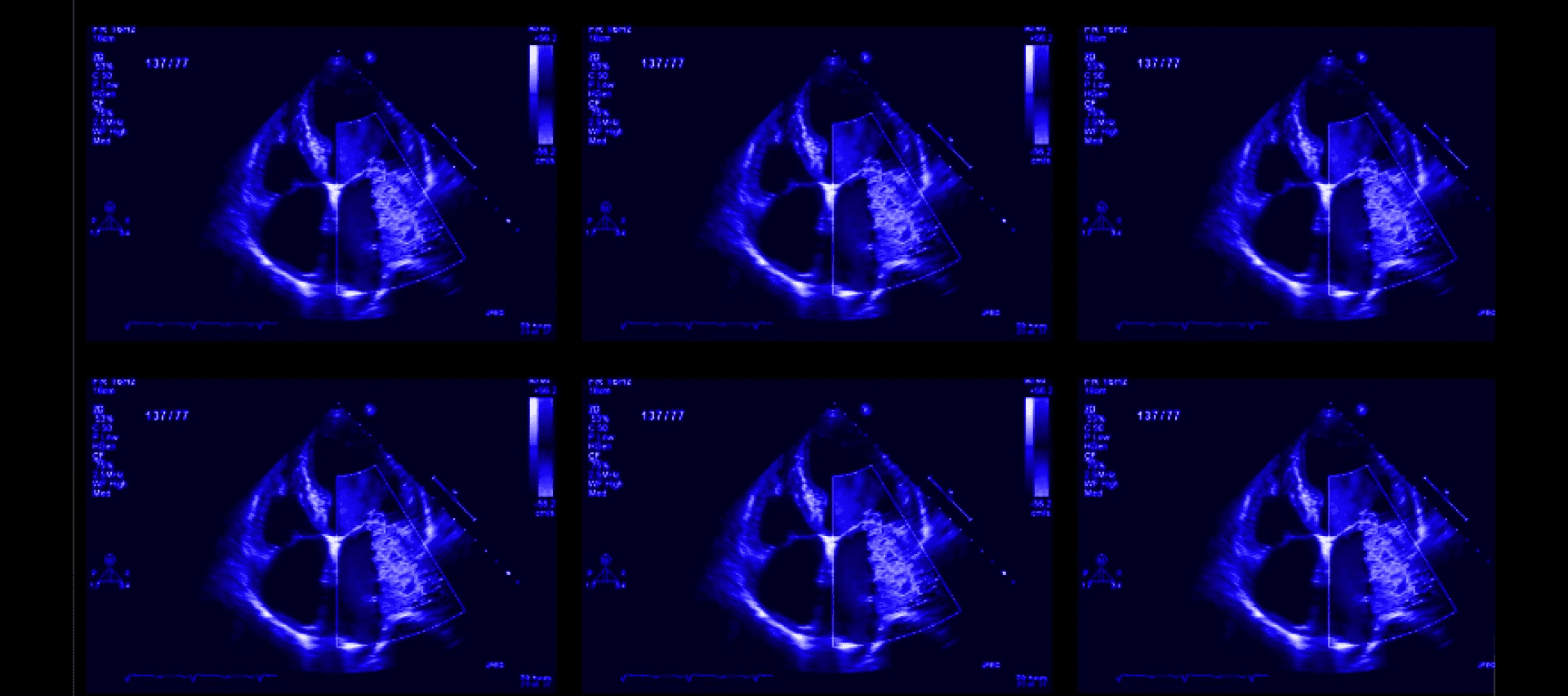 hero-8-v4_hero-8-v4_image